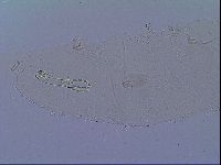 Mesobiotus snaresensis image