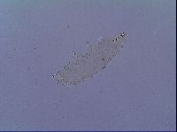 Mesobiotus snaresensis image