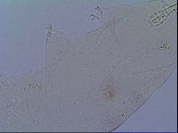 Mesobiotus snaresensis image
