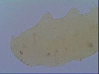 Mesobiotus snaresensis image