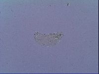 Mesobiotus snaresensis image