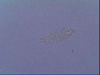 Mesobiotus snaresensis image