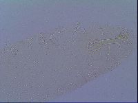Mesobiotus snaresensis image