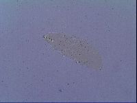 Mesobiotus snaresensis image