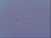Doryphoribius zyxiglobus image