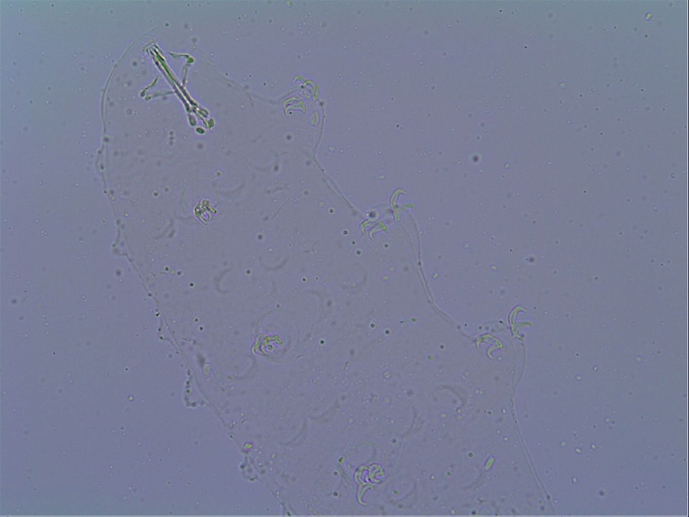 Doryphoribius zyxiglobus image