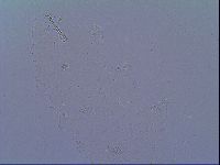Doryphoribius zyxiglobus image