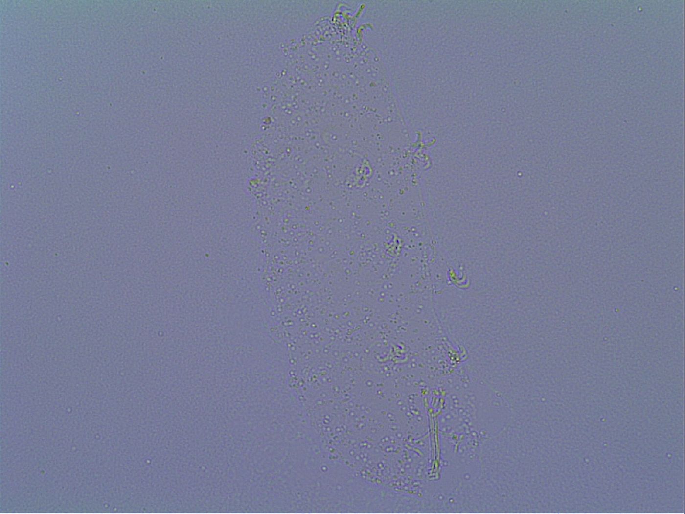 Doryphoribius zyxiglobus image