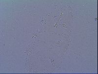 Doryphoribius zyxiglobus image