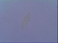 Doryphoribius zyxiglobus image