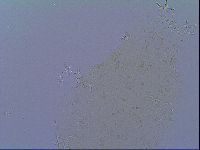 Doryphoribius zyxiglobus image