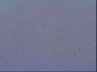 Doryphoribius zyxiglobus image