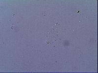 Media resource of Doryphoribius zyxiglobus