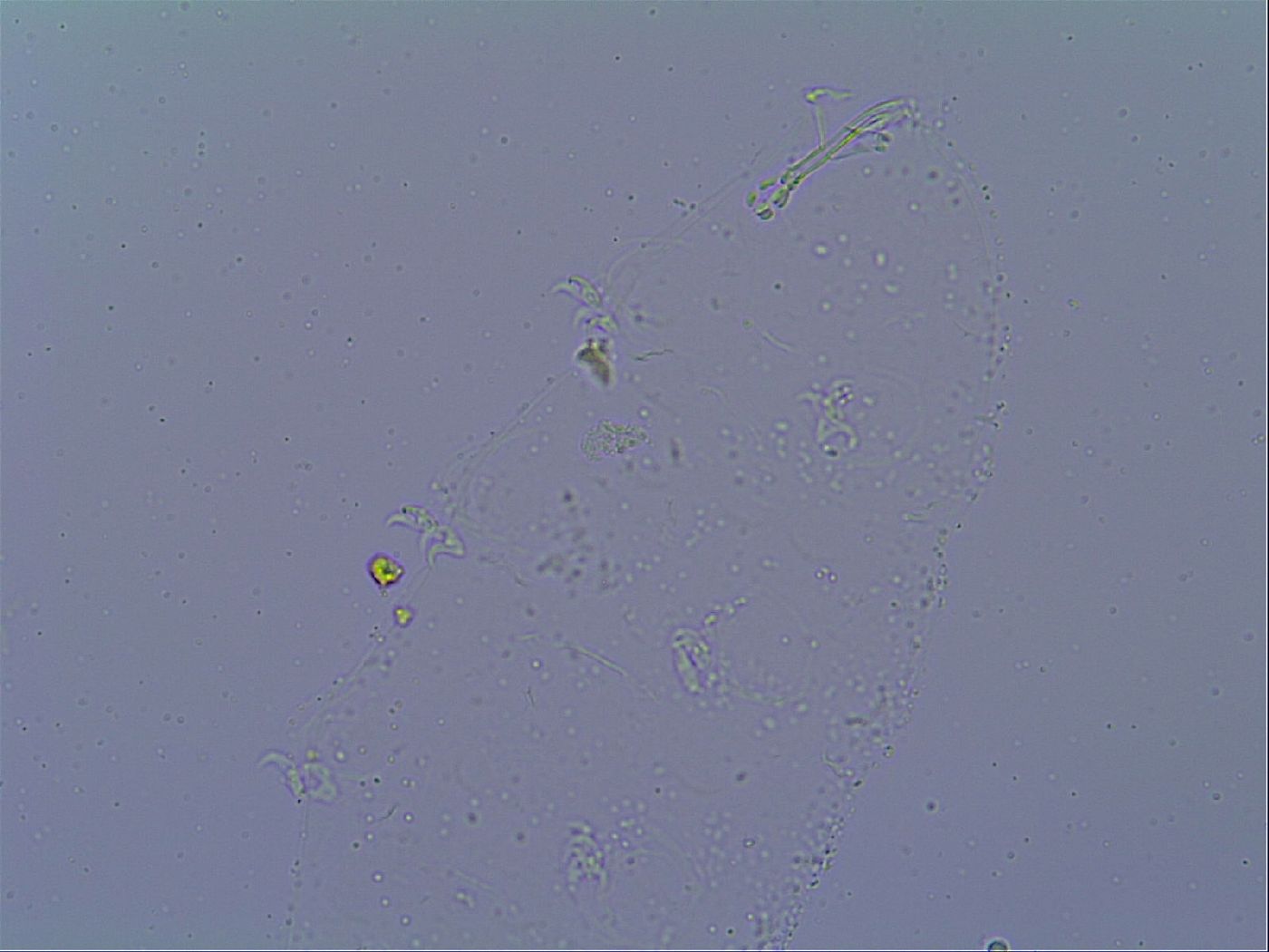 Doryphoribius zyxiglobus image