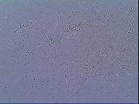 Doryphoribius zyxiglobus image