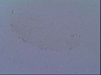 Doryphoribius zyxiglobus image
