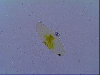 Tenuibiotus tenuis image