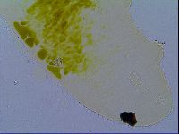 Tenuibiotus tenuis image