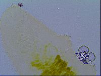 Tenuibiotus tenuis image