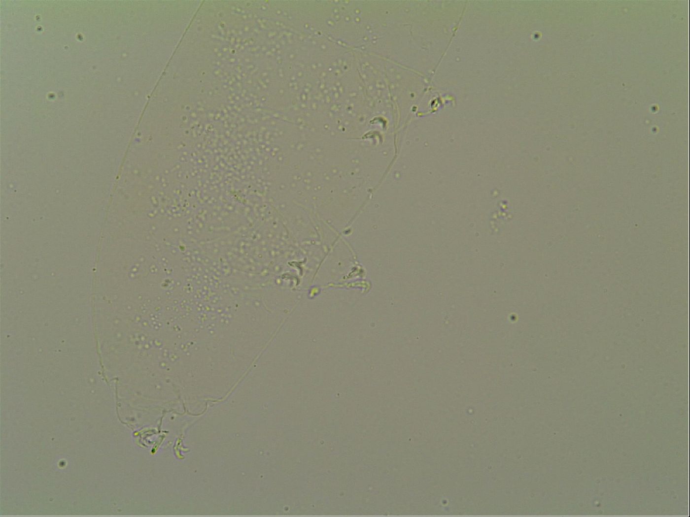 Macrobiotus topali image