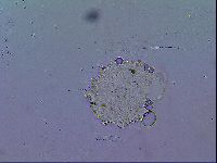 Mesobiotus stellaris image