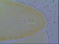 Macrobiotus spectabilis image