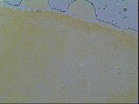 Macrobiotus spectabilis image