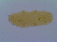 Macrobiotus hufelandi image