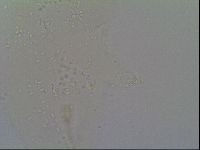 Minibiotus intermedius image