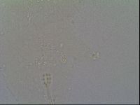 Minibiotus intermedius image