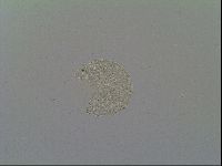 Mesobiotus montanus image