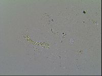 Macrobiotus islandicus image