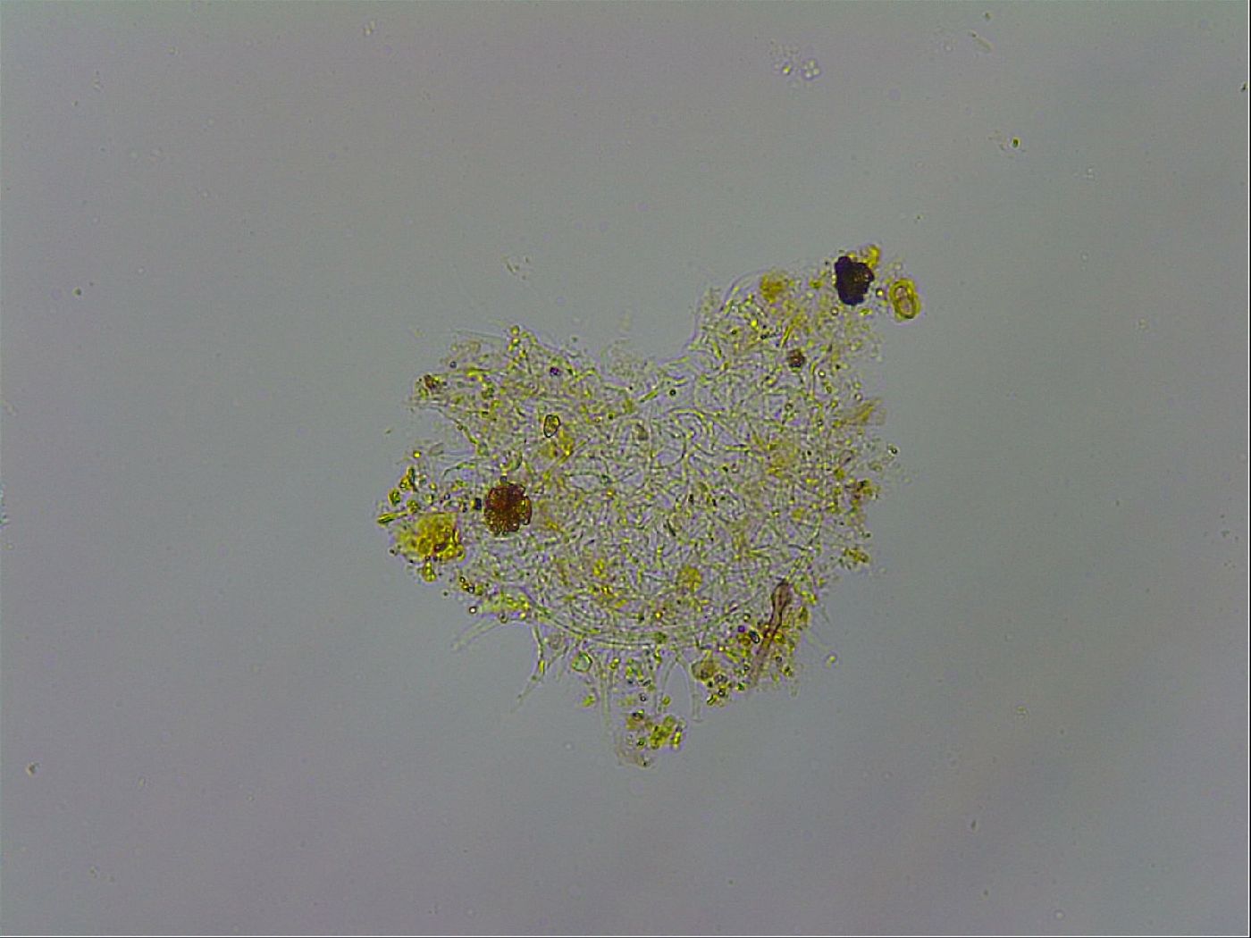 Macrobiotus annae image