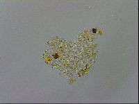 Media resource of Macrobiotus annae