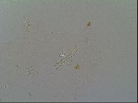 Macrobiotus recens image