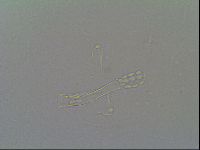 Media resource of Macrobiotus harmsworthi