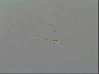 Macrobiotus islandicus image