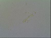 Macrobiotus islandicus image