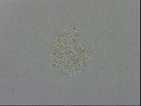 Macrobiotus hibiscus image
