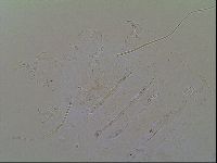 Novechiniscus armadilloides image