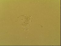 Novechiniscus armadilloides image