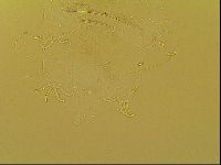 Novechiniscus armadilloides image