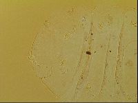 Novechiniscus armadilloides image