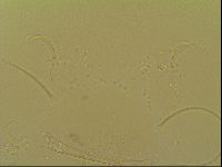 Novechiniscus armadilloides image