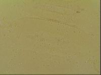 Novechiniscus armadilloides image