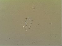 Novechiniscus armadilloides image