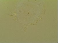 Novechiniscus armadilloides image