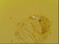 Novechiniscus armadilloides image