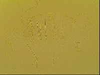 Novechiniscus armadilloides image
