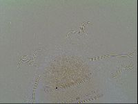 Novechiniscus armadilloides image